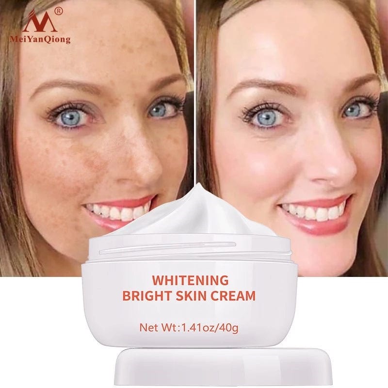 Dark Spot Removal Whitening Cream